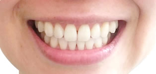 �z���C�g�j���O