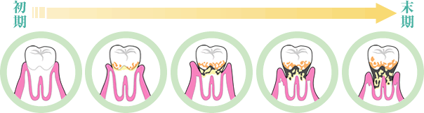 �����a�̐i�s�x